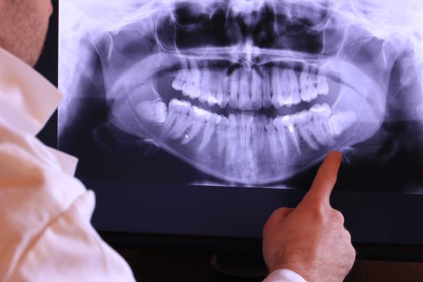 Best Emergency Dental Services for Seniors in Henrietta, TX