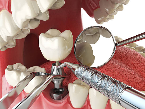 Best Emergency Cosmetic Dentistry in Henrietta, TX