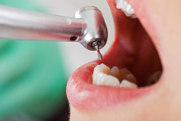 Best Orthodontic Emergency Dentist in Henrietta, TX